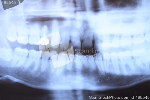 Image of teeth