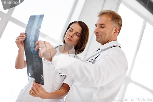 Image of doctors with x-ray of spine at hospital