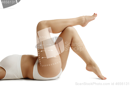 Image of Female body with the drawing arrows. Fat lose, liposuction and cellulite removal concept