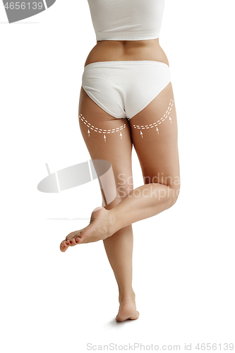 Image of Female body with the drawing arrows. Fat lose, liposuction and cellulite removal concept