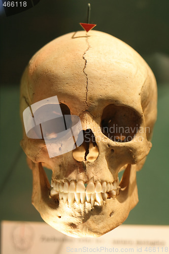Image of human skull