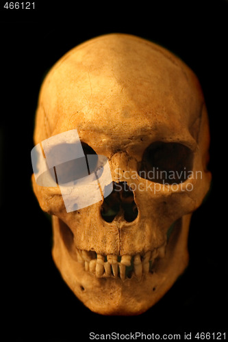 Image of human skull