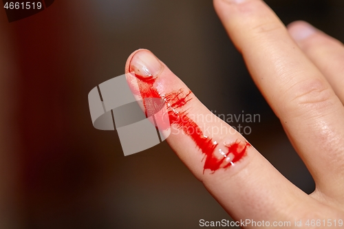 Image of Cut finger bleeding