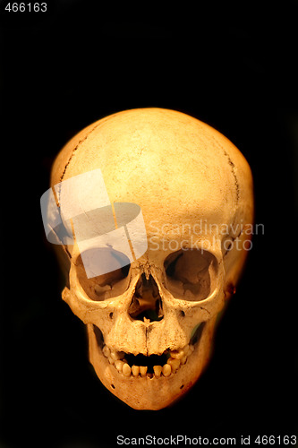 Image of human skull