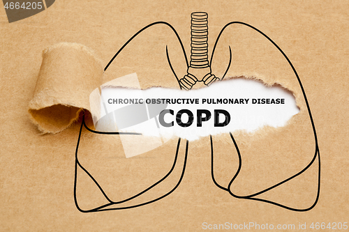 Image of Chronic Obstructive Pulmonary Disease COPD Concept