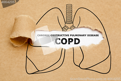 Image of Chronic Obstructive Pulmonary Disease COPD Concept