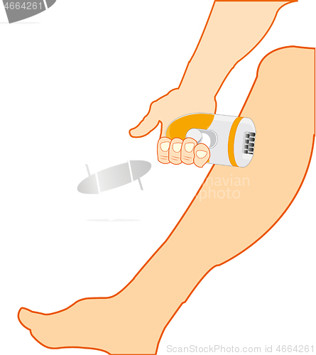 Image of Leg of the person and instrument epilator