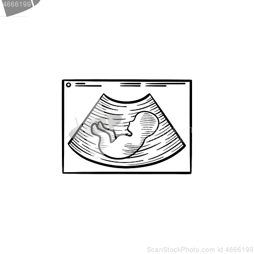 Image of Baby silhouette on ultrasound hand drawn outline doodle icon.