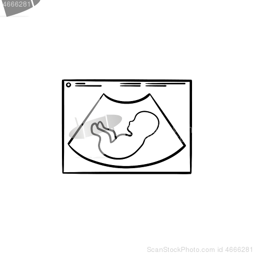 Image of Fetus silhouette on ultrasound hand drawn outline doodle icon.