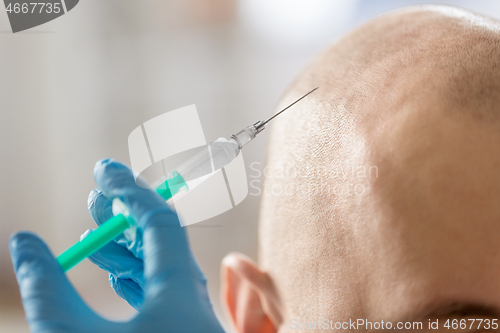 Image of close up of hands with syringe and bald male head