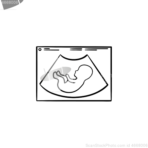 Image of Fetal ultrasound hand drawn outline doodle icon.