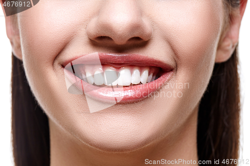 Image of smiling woman with white teeth