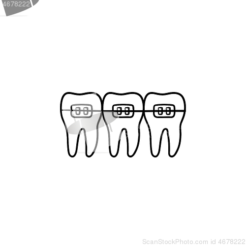 Image of Dental braces hand drawn outline doodle icon.