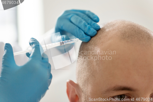 Image of close up of hands with syringe and bald male head