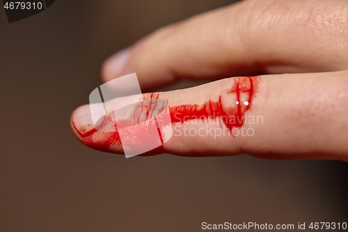 Image of Cut finger bleeding