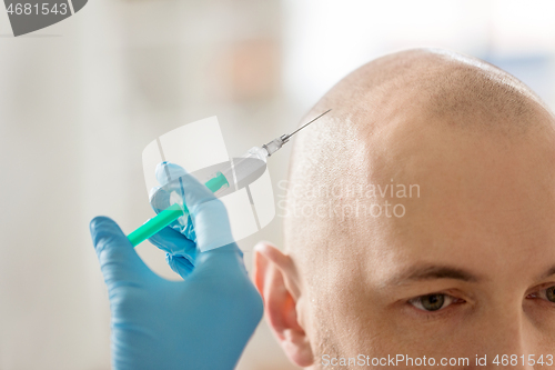 Image of close up of hands with syringe and bald male head