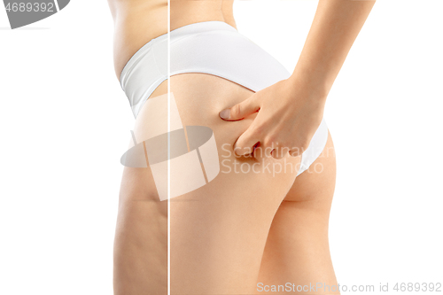 Image of Overweight woman with fat cellulite legs and buttocks, obesity female body in white underwear comparing with fit and thin body isolated on white background