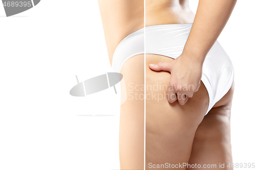 Image of Overweight woman with fat cellulite legs and buttocks, obesity female body in white underwear comparing with fit and thin body isolated on white background