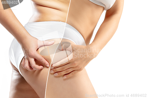 Image of Overweight woman with fat cellulite legs and buttocks, obesity female body in white underwear comparing with fit and thin body isolated on white background