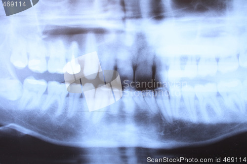 Image of teeth