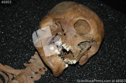 Image of Skull