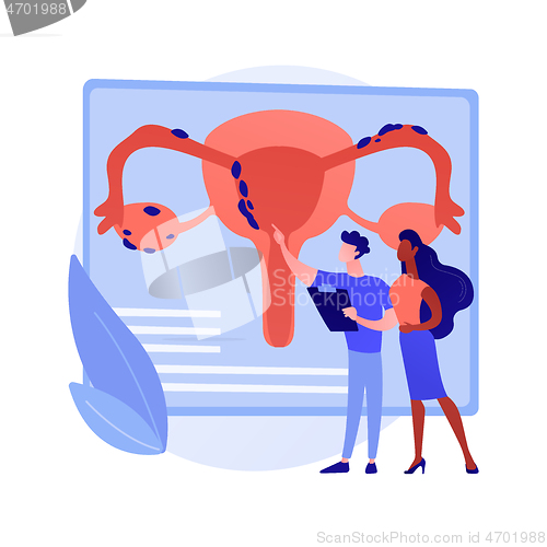 Image of Endometriosis abstract concept vector illustration.