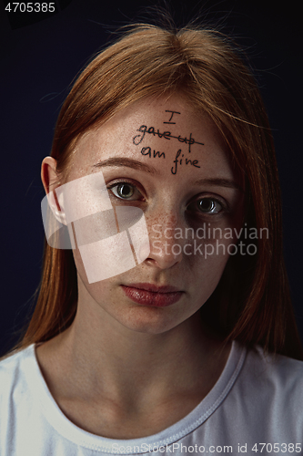 Image of Young woman with mental health problems