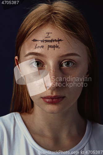 Image of Young woman with mental health problems