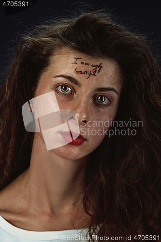 Image of Young woman with mental health problems