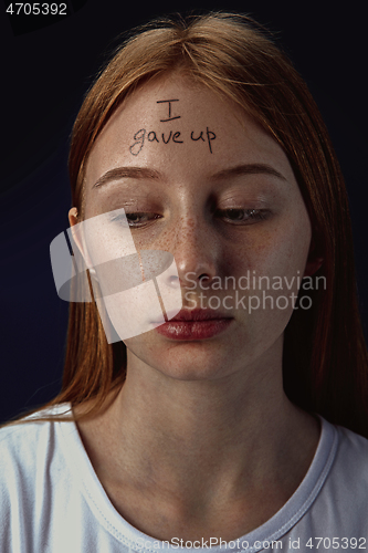 Image of Young woman with mental health problems