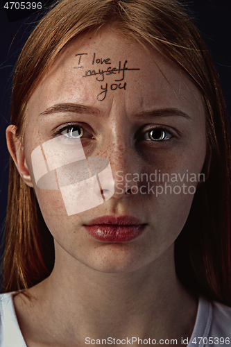 Image of Young woman with mental health problems