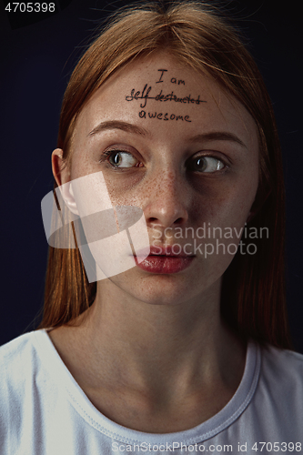 Image of Young woman with mental health problems