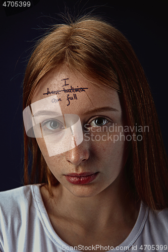 Image of Young woman with mental health problems