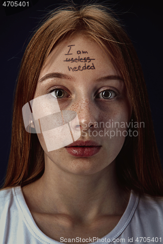 Image of Young woman with mental health problems