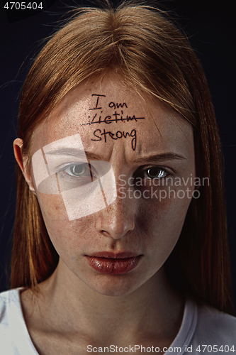 Image of Young woman with mental health problems