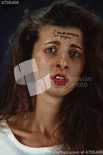 Image of Young woman with mental health problems