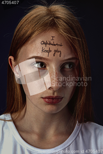 Image of Young woman with mental health problems