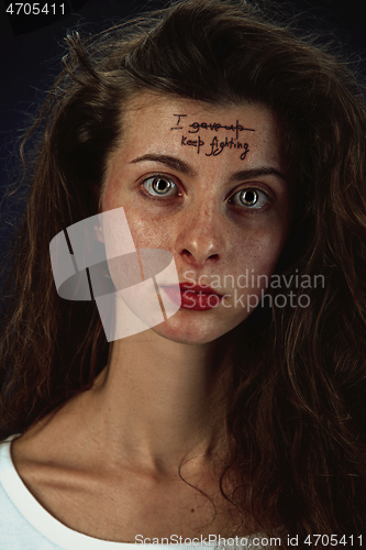 Image of Young woman with mental health problems