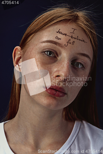 Image of Young woman with mental health problems