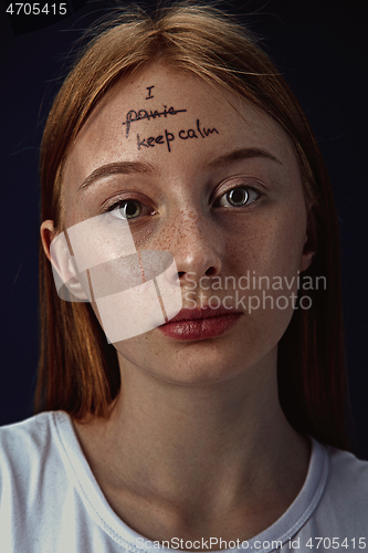 Image of Young woman with mental health problems