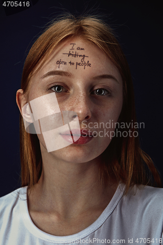 Image of Young woman overcoming mental health problems