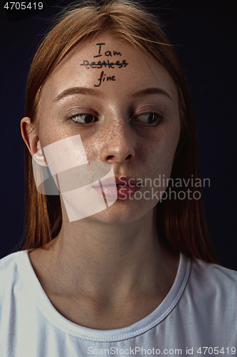 Image of Young woman with mental health problems