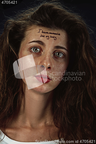 Image of Young woman with mental health problems