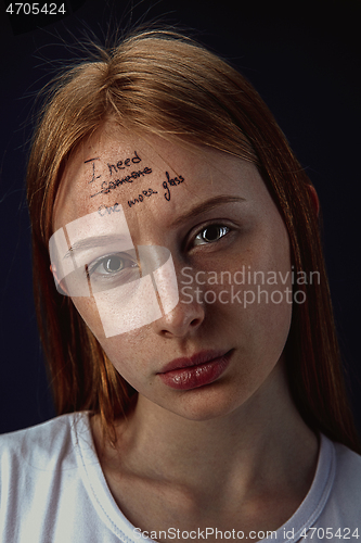 Image of Young woman with mental health problems