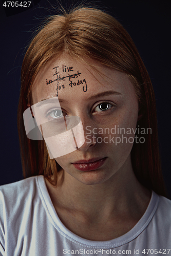 Image of Young woman with mental health problems