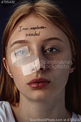 Image of Young woman with mental health problems