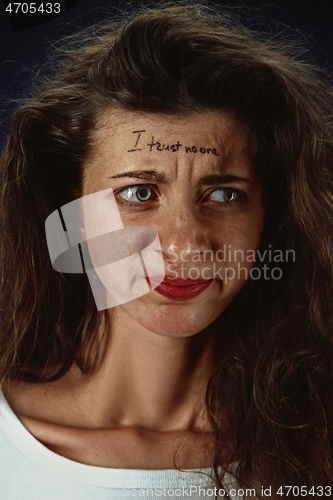 Image of Young woman with mental health problems