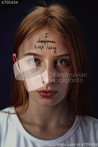 Image of Young woman with mental health problems