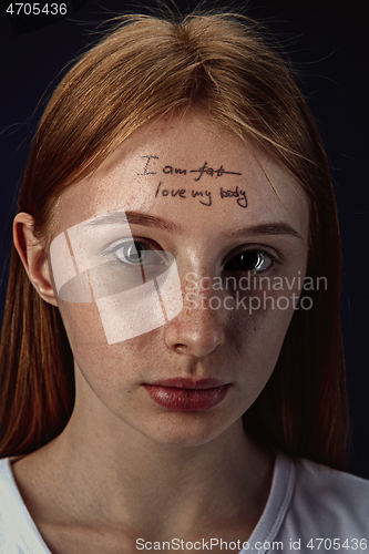 Image of Young woman with mental health problems