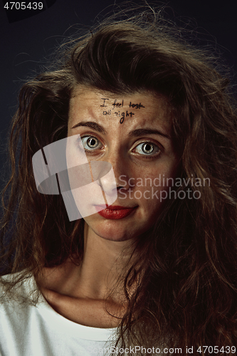 Image of Young woman with mental health problems